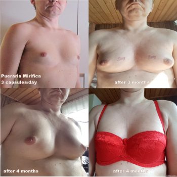 Sissyboobs - before after