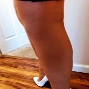 yp