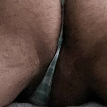 1000010388