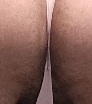 1000041179