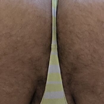 1000042871