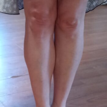 Legs (31)